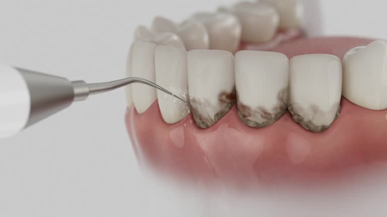 Reliable Dental contractor in Mount Vernon, OH by Dentist Open Now